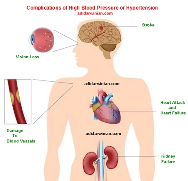 علاج ارتفاع ضغط الدم العصبيعلاج ارتفاع ضغط الدم العصبي