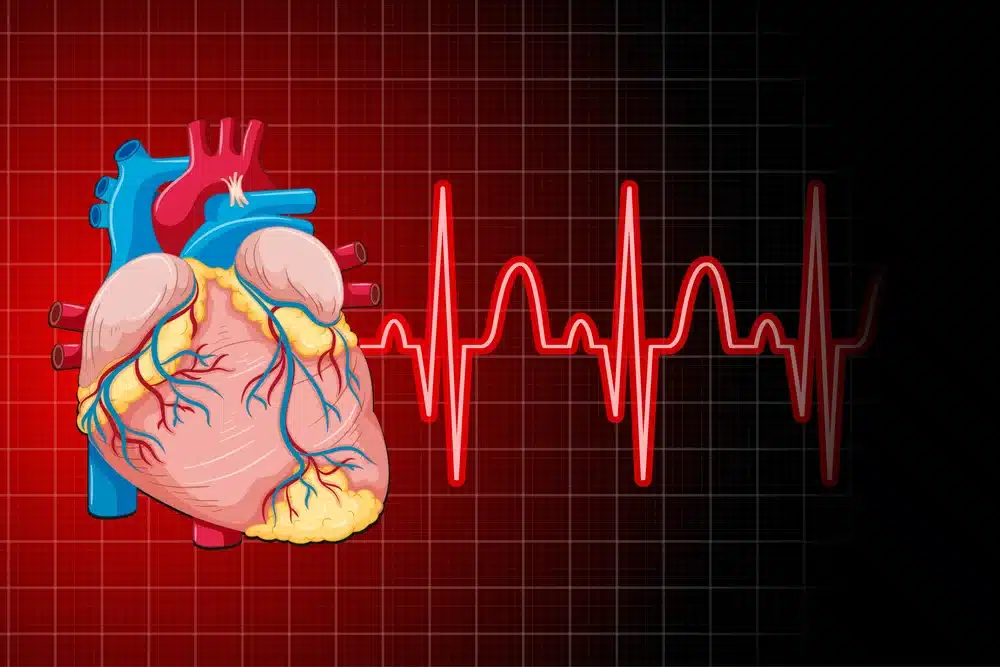 كم تستغرق عملية دعامة القلب