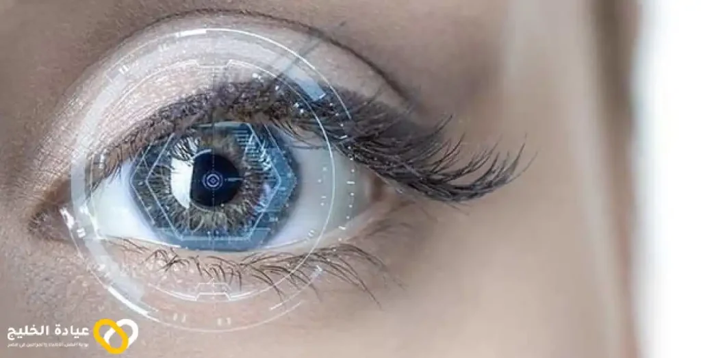 نسبة نجاح عملية الليزر للعيون